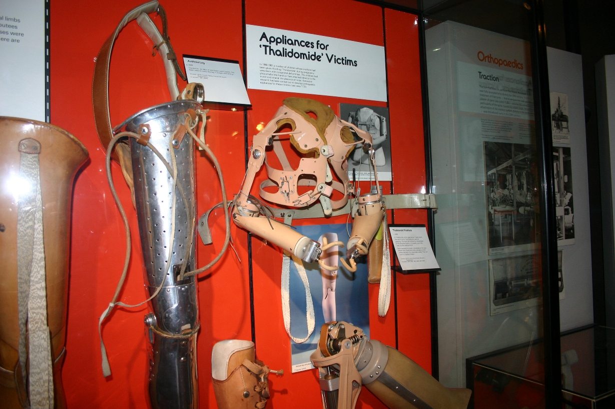 Appliances for Thalidomide victims, Science Museum, London - 01.JPG